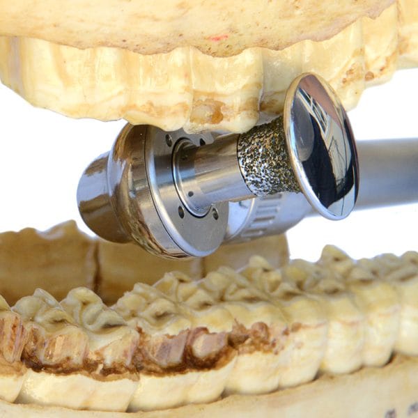 Dynamic Buccal Burr - For Dynamic Blades System